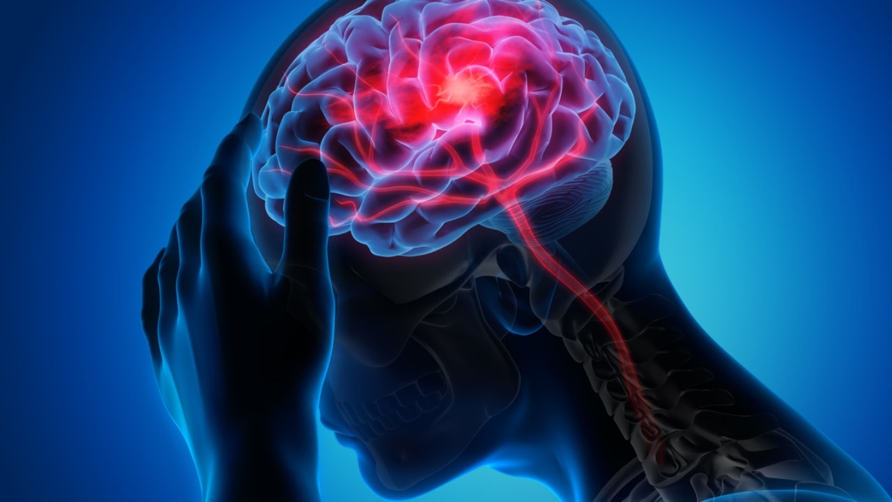 Stroke risk: What to know