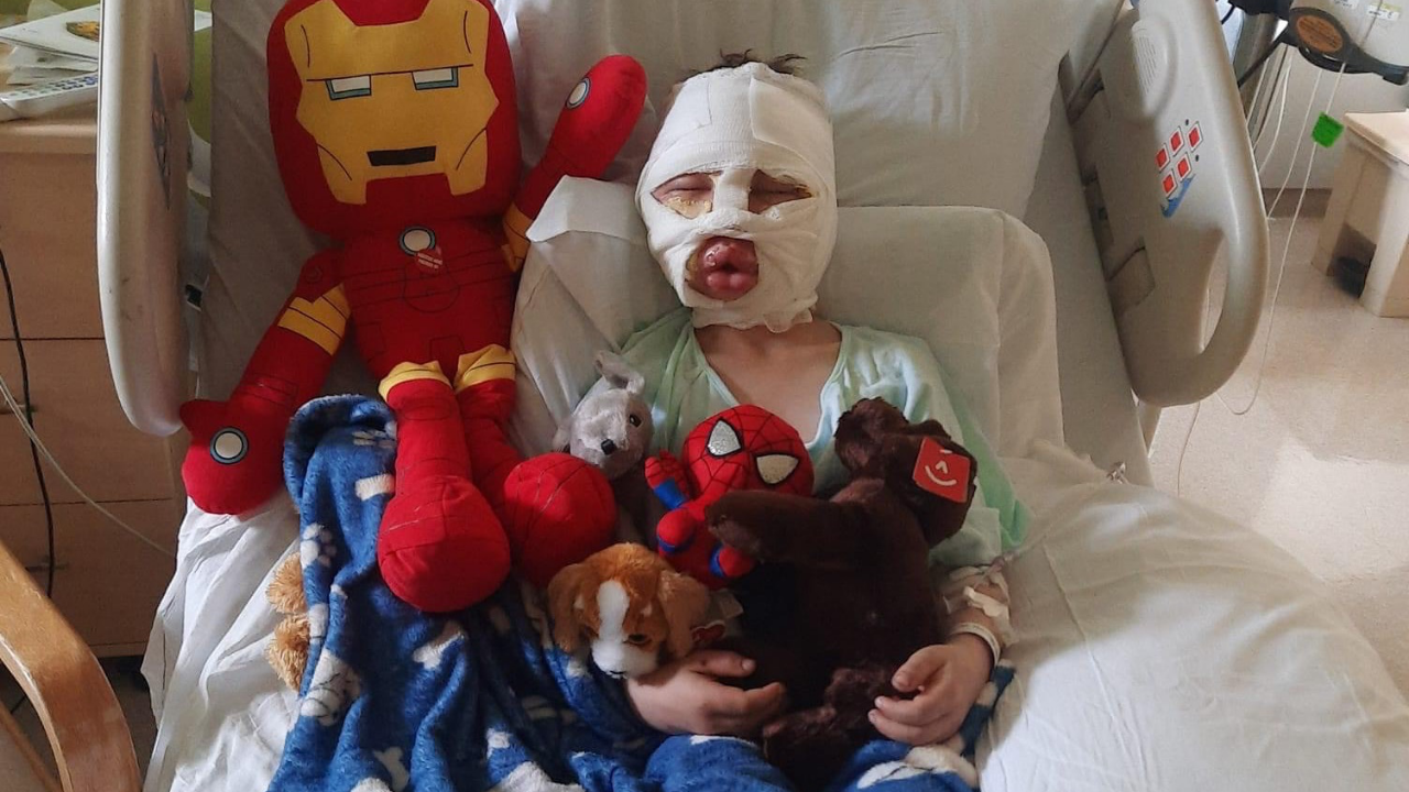 Connecticut family hosts parade for 6-year-old boy who was burned in alleged bullying incident