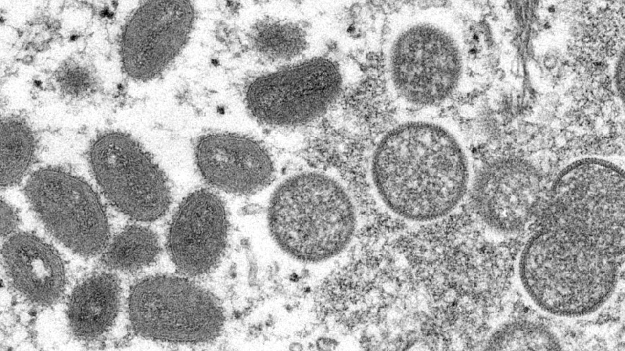 WHO Meeting Over Monkeypox Virus Spread: Report - Gadget Clock