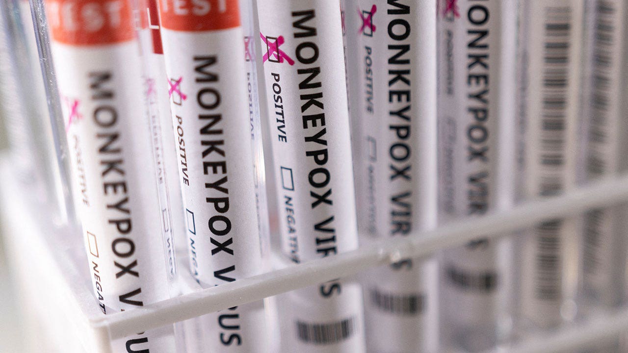 WHO to rename monkeypox to avoid discrimination and stigmatization – Fox News