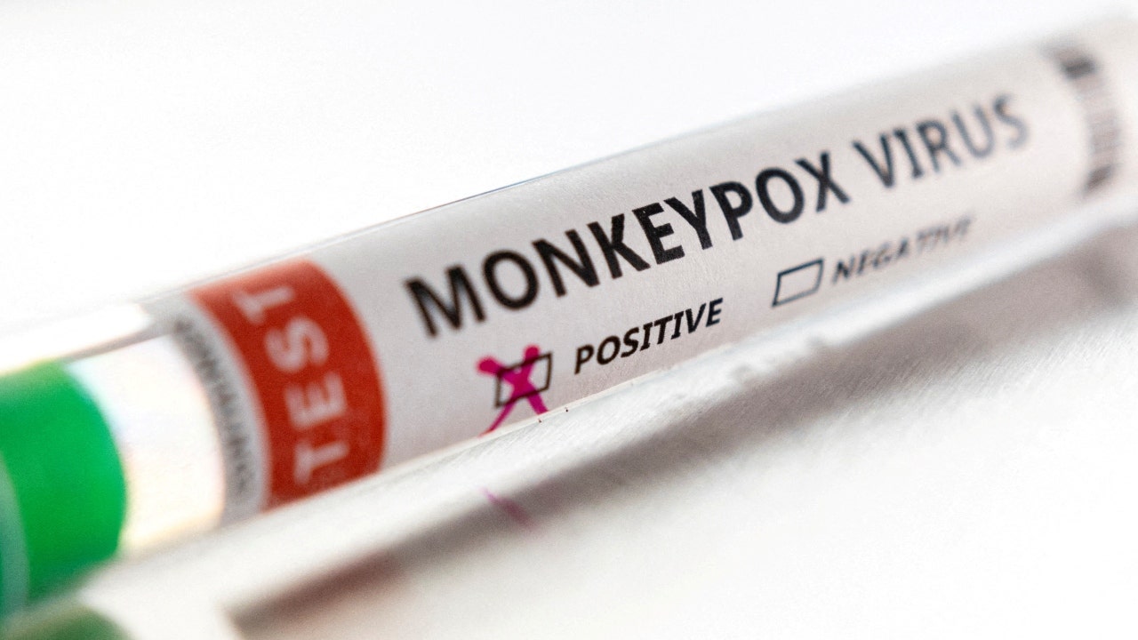 La viruela del mono cambia más de lo que se pensaba anteriormente, dicen los investigadores