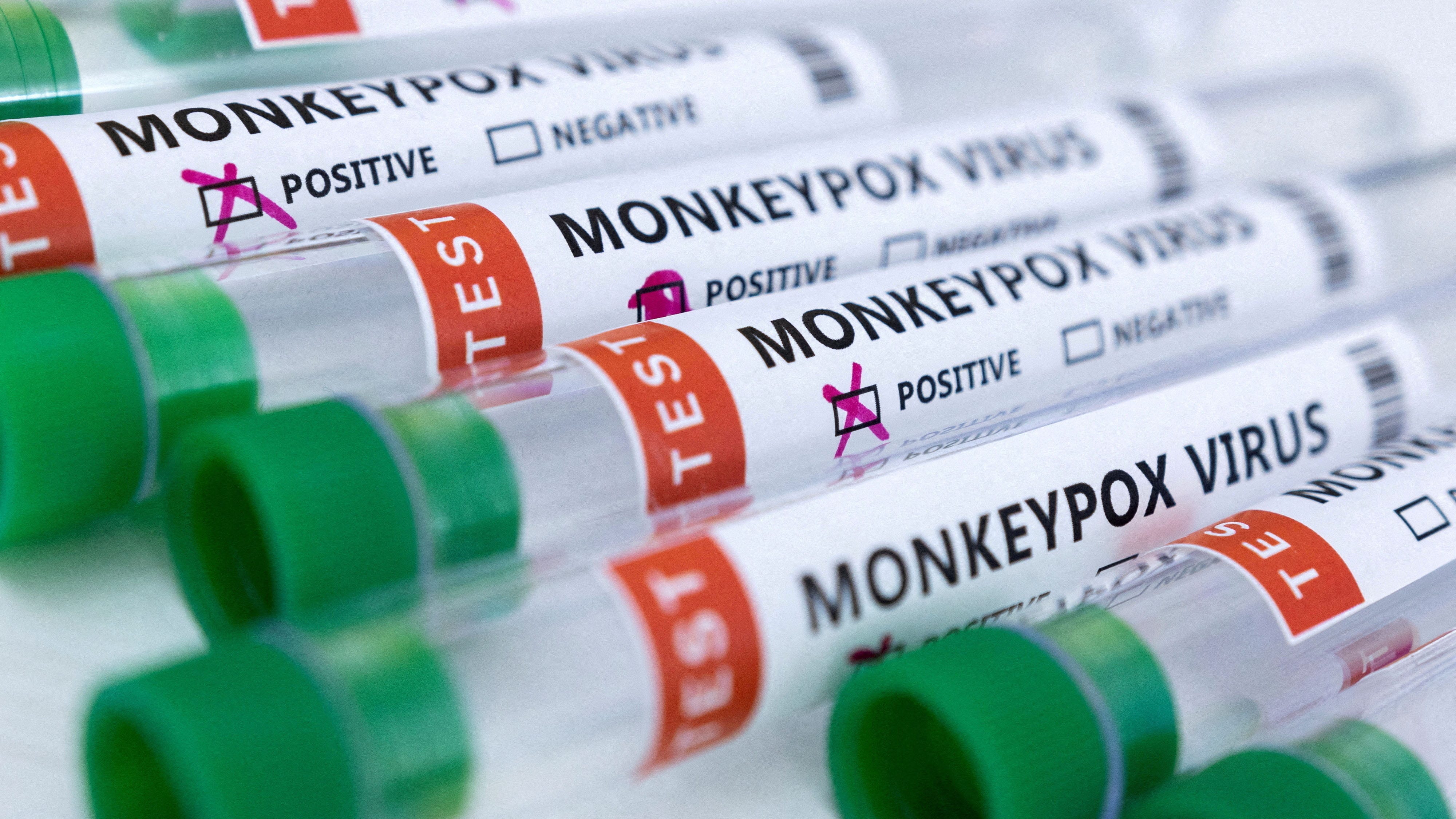 French health body indicates at-risk groups to be vaccinated against monkeypox