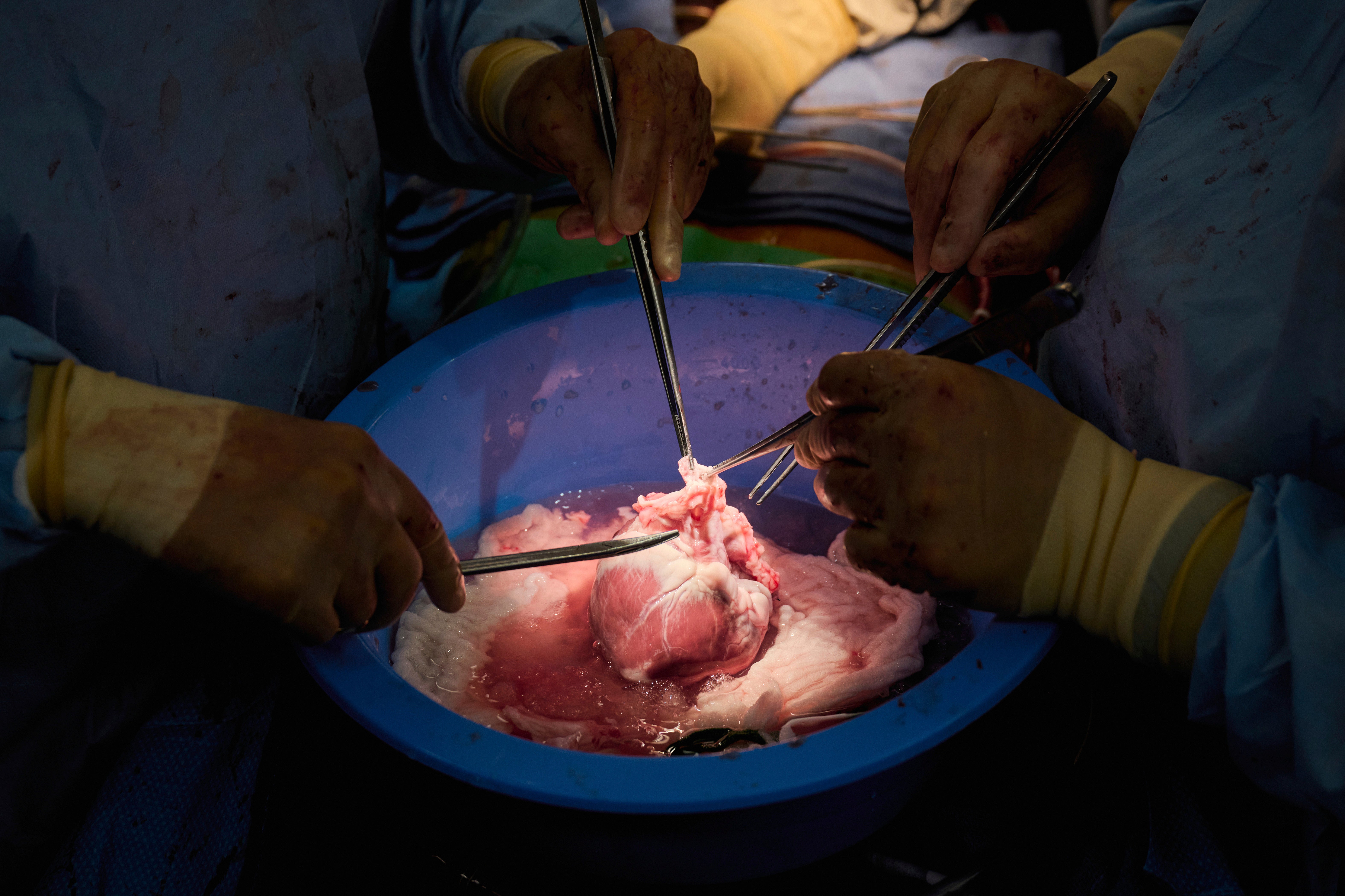 Pig organ transplants being tested on dead human bodies