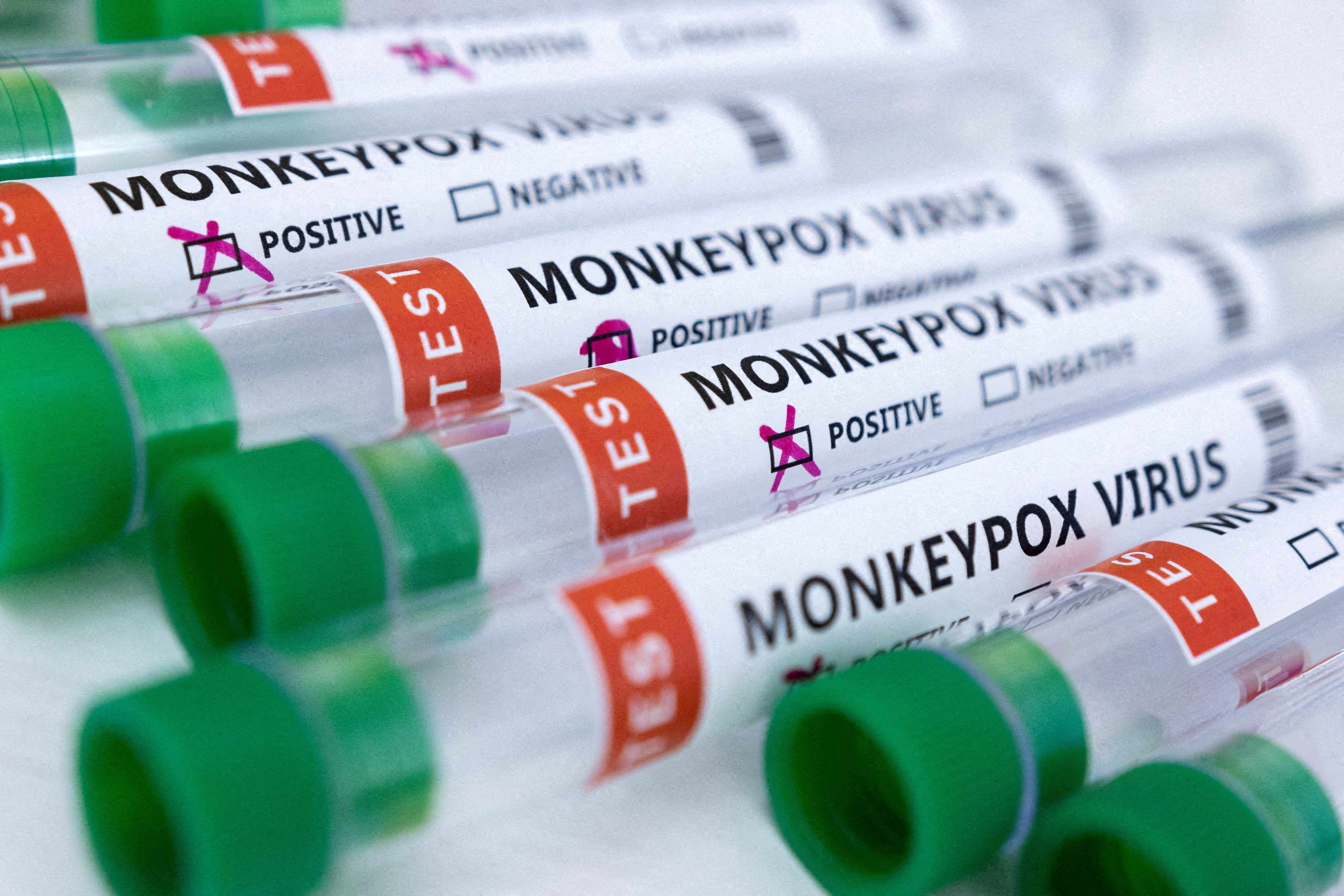 Biden announces White House monkeypox response team with 3 states declaring emergencies
