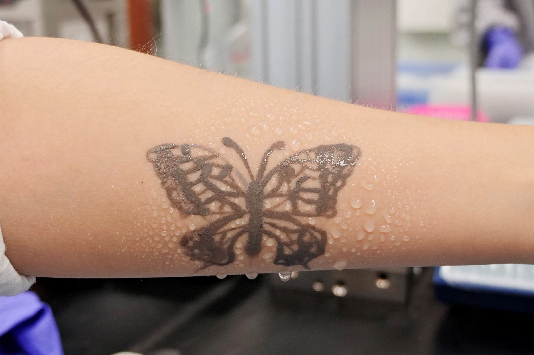 South Korea develops electronic tattoo that can alert patients to possible health problems