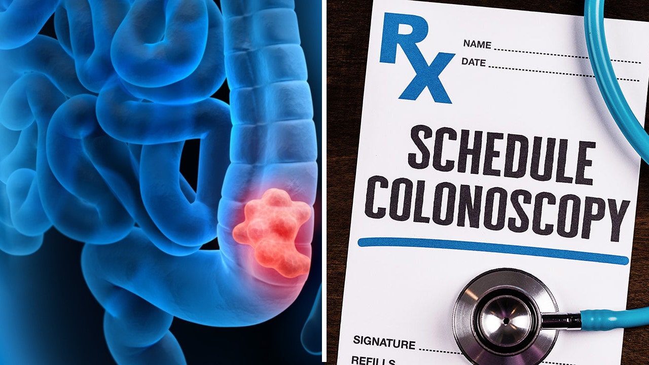Health expert, citing 'grave concern,' says results of new colonoscopy study are 'wildly' misinterpreted