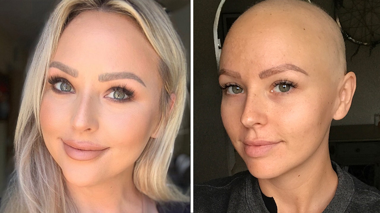 California woman with stage 4 breast cancer denied mammogram at age 29: 'I'll be fighting forever'