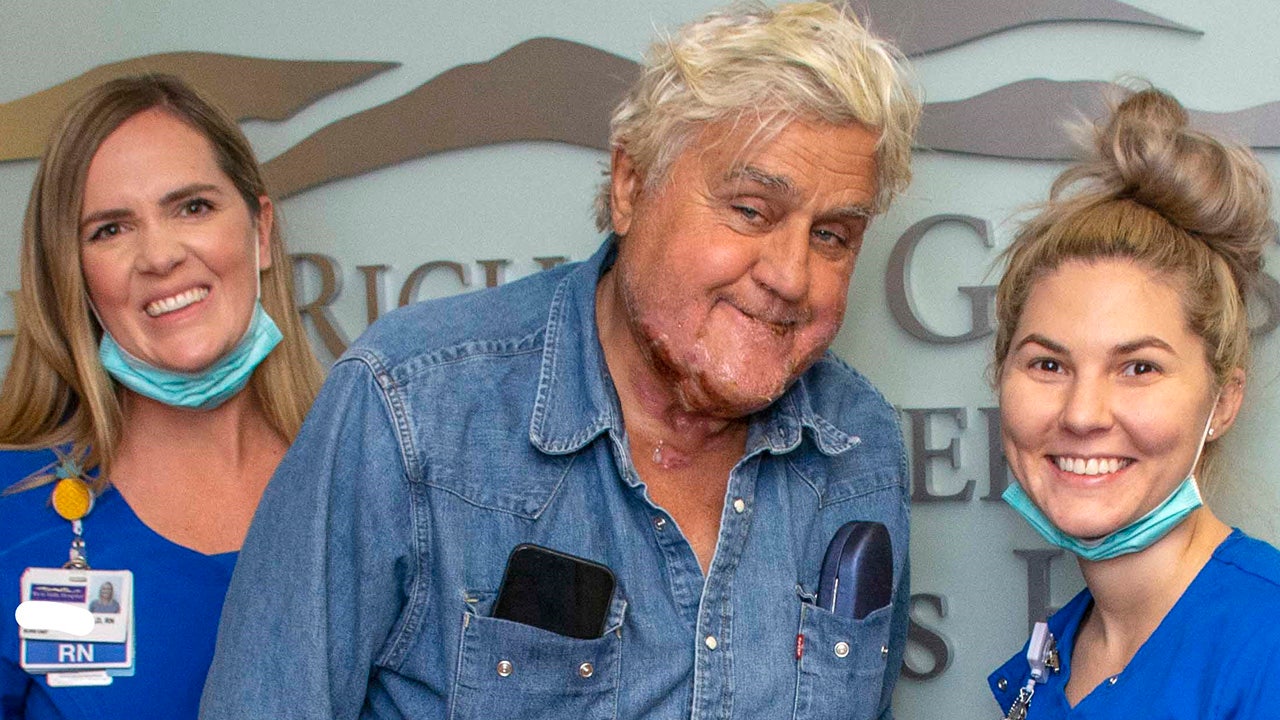 Jay Leno reveals burns from fire released from hospital – Fox News