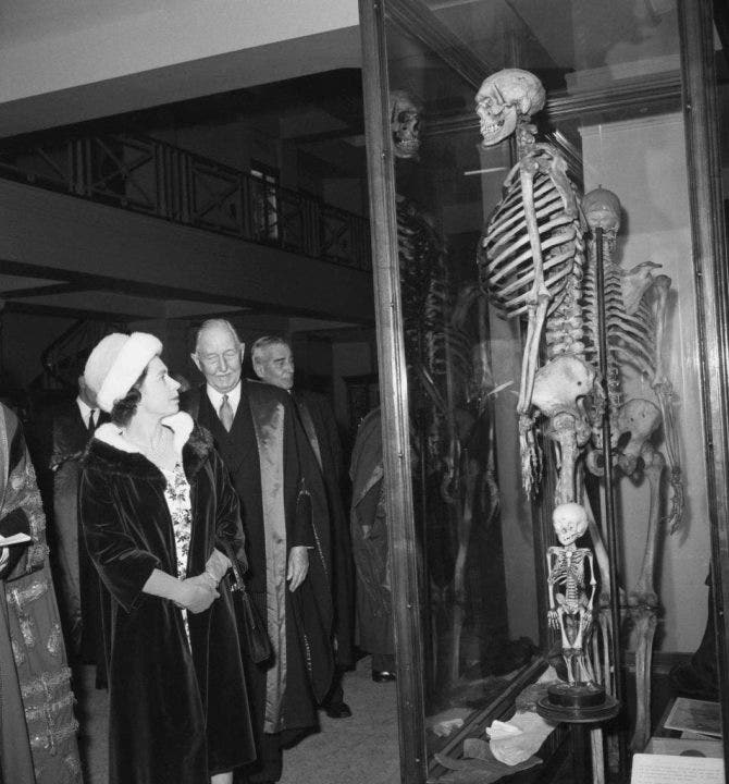 London's 'Irish Giant': Museum wants to remove controversial skeleton display