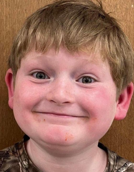Justin Gilstrap, 11, of Georgia is recovering in the hospital after he suffered an attack by three loose pit bulls while he was riding his bicycle. (Ericka Stevens)