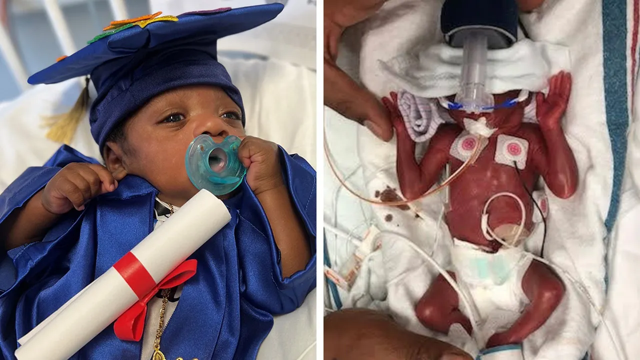 Micro-preemie born ‘on the edge of viability’ in Texas celebrates 1st birthday: ‘Quite the survivor’