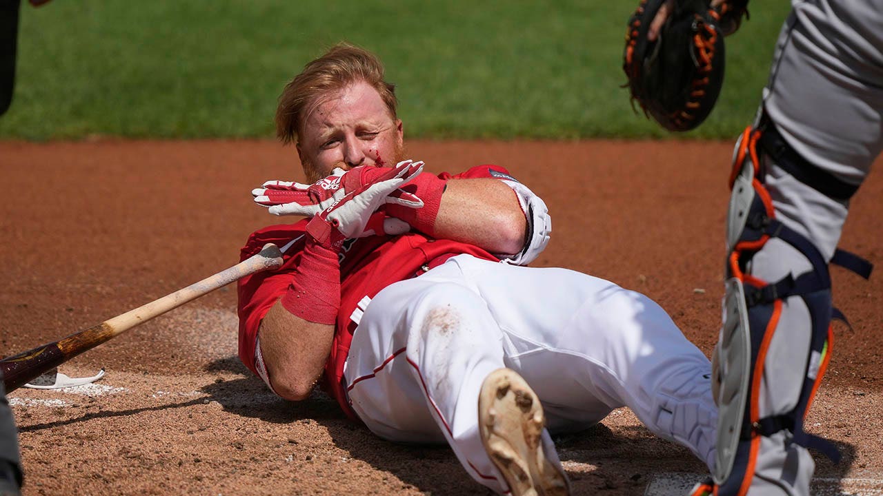 Red Sox's Justin Turner 'feeling very fortunate' after pitch to
