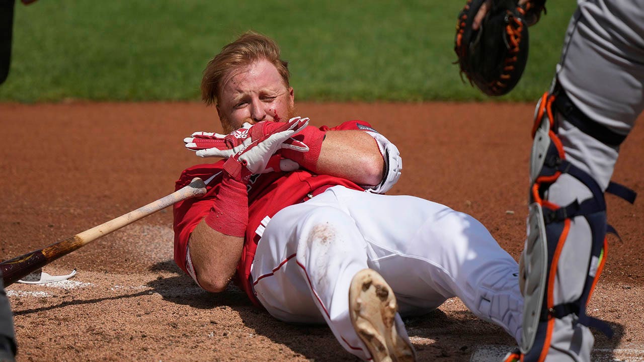 Red Sox' Justin Turner Hospitalized After Being Hit in Face by Pitch