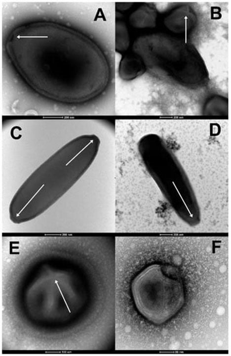 Scientists revive ancient ‘zombie viruses’ from Siberian permafrost that can infect amoeba cells