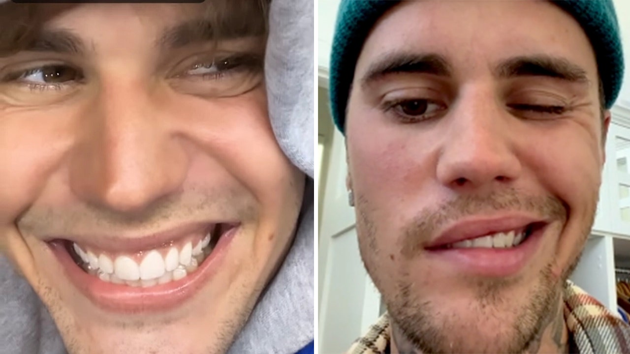 Justin Bieber Shares Update on Facial Mobility After Ramsay Hunt Syndrome  Diagnosis