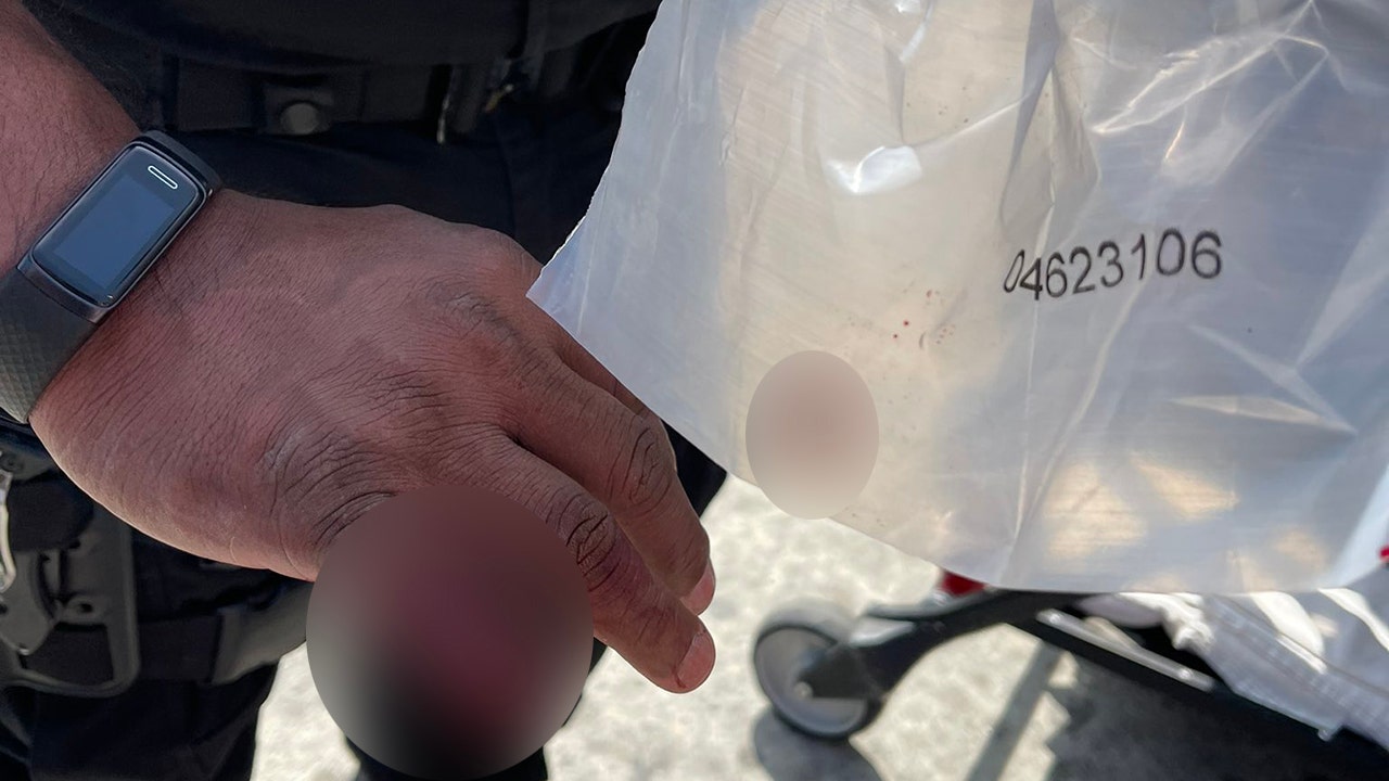 News :Los Angeles police officer loses part of finger bitten off by homeless man, LAPD says