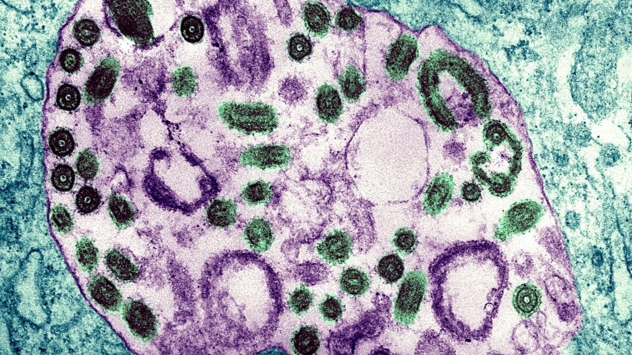 Marburg virus: CDC warns US public health officials of Ebola-like disease