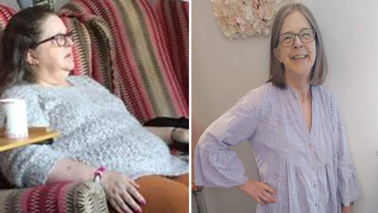 Daily selfies help woman lose 124 pounds, Fox News