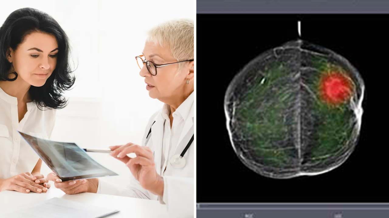 AI technology used to read mammograms could put patients at potential risk: study