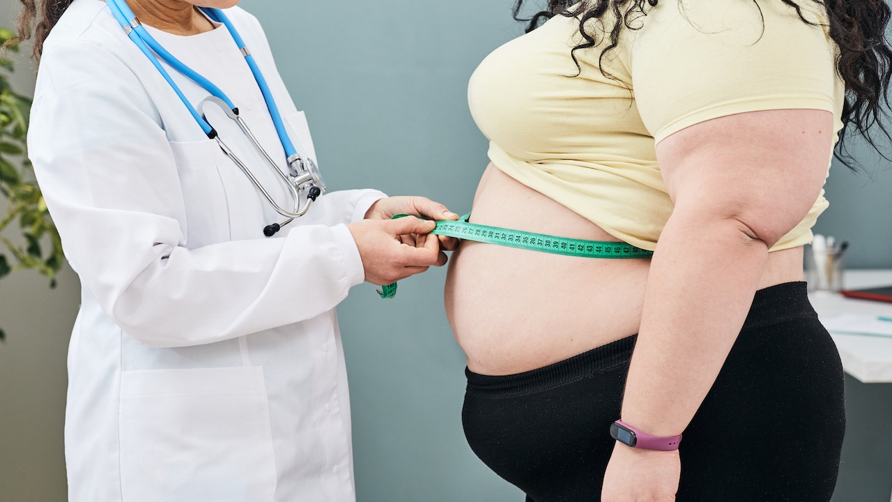 Woman with obesity at doctor