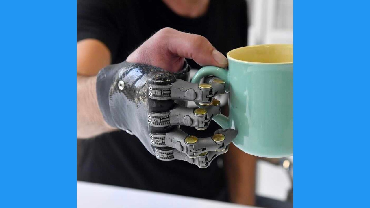 prosthetic hand with a mug