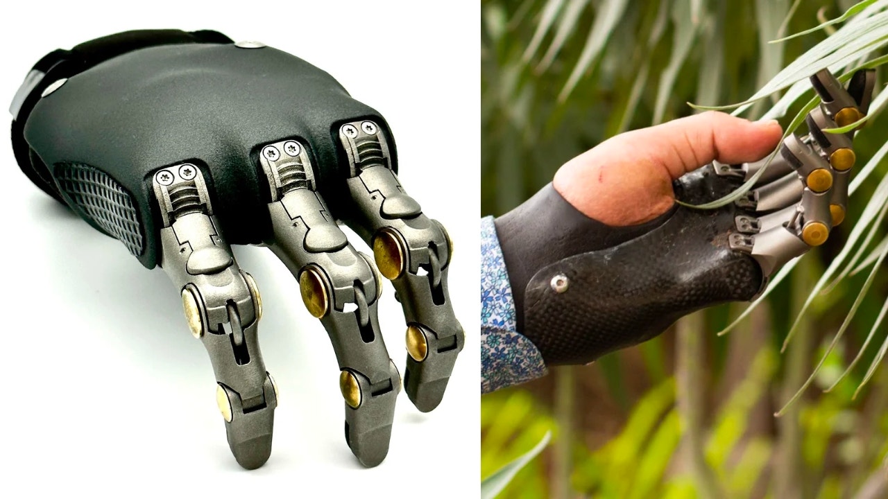 prosthetic hand