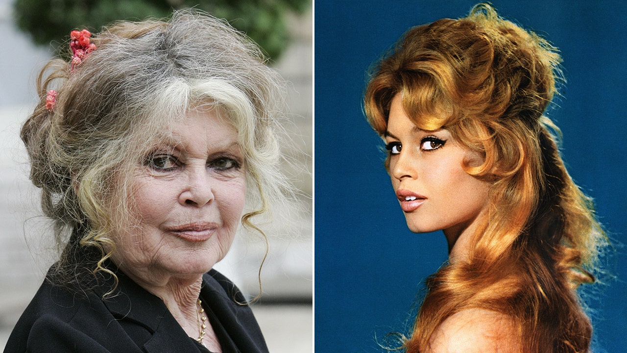 Brigitte Bardot, 88, recovering after first responders treated