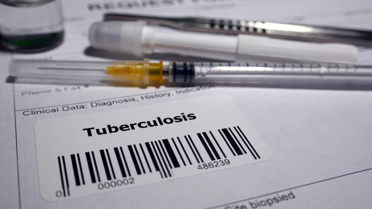 Test de tuberculose