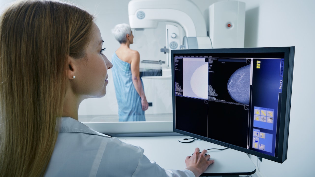 AI tech aims to detect breast cancer by mimicking radiologists’ eye movements: ‘A critical friend’