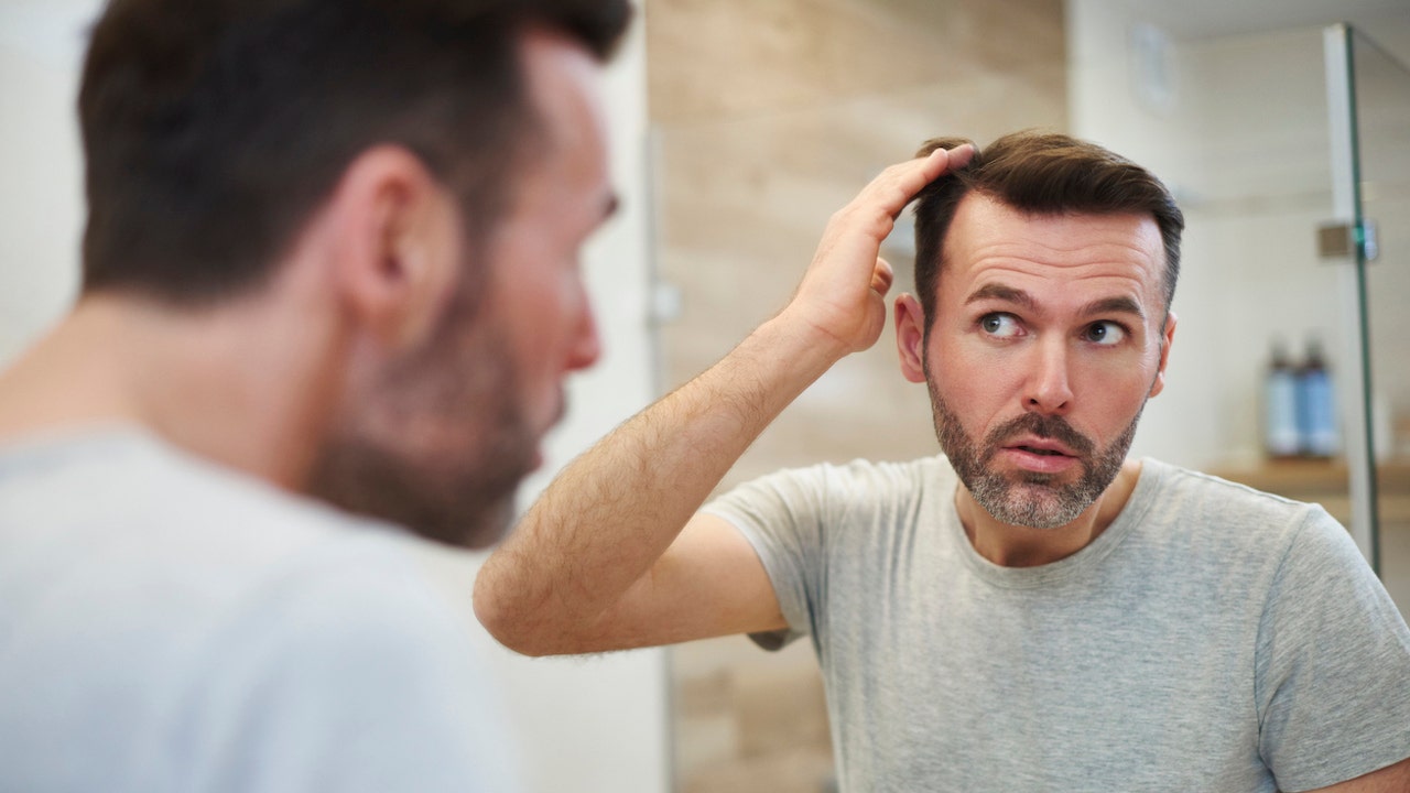 Perte de cheveux homme