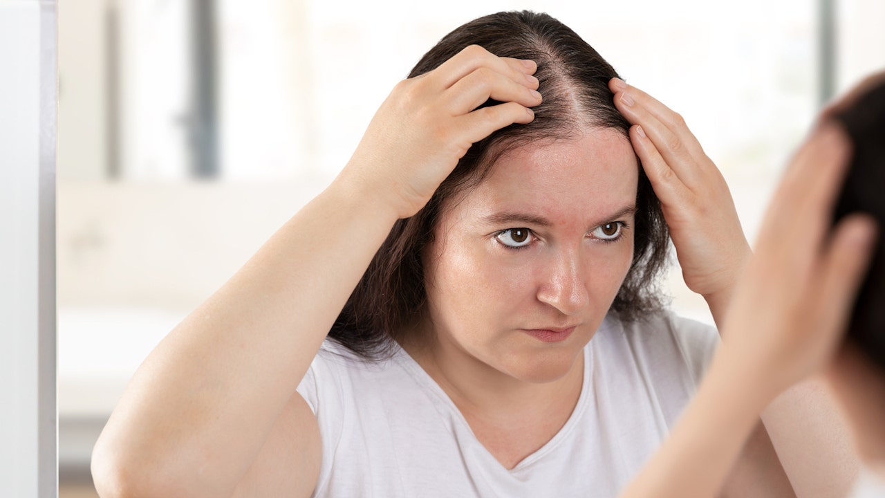 Woman hair loss