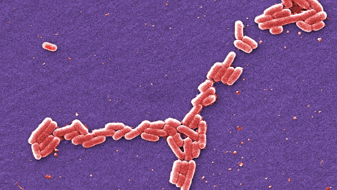 4 students hospitalized in E. coli outbreak at the University of Arkansas