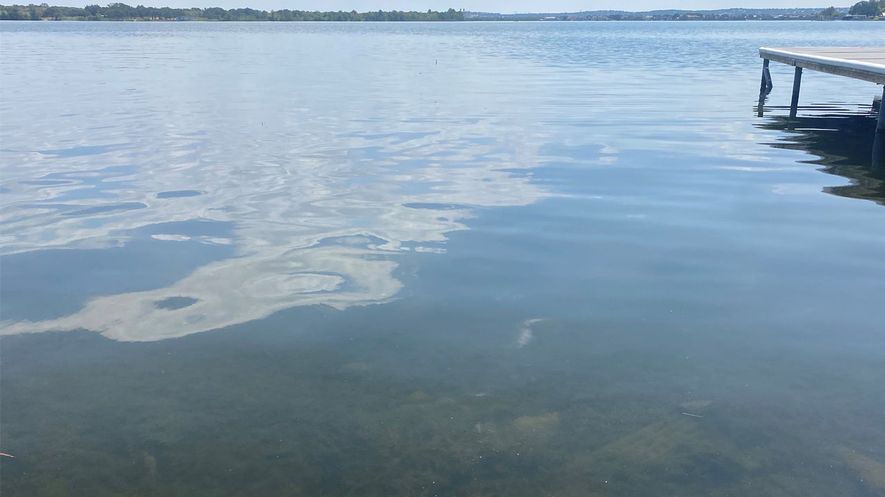 texas-resident-dies-from-rare-amoeba-infection-after-swimming-in-lake