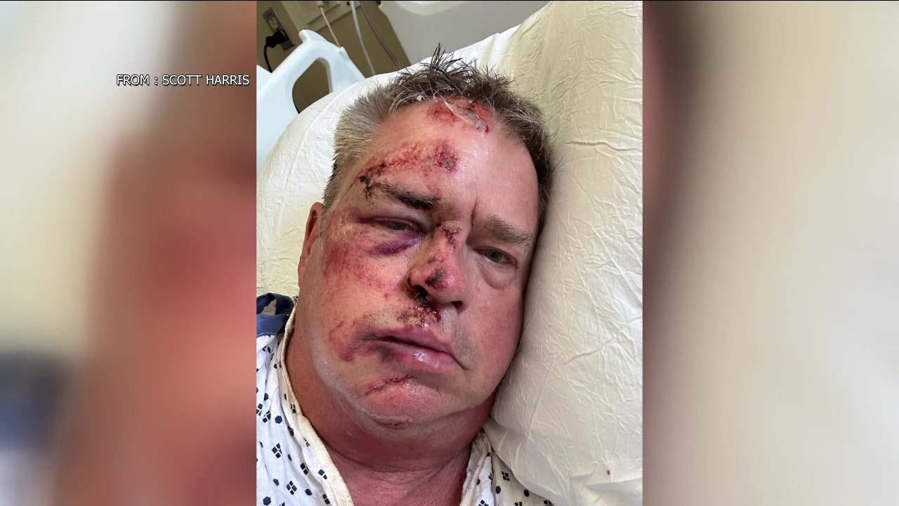 Navy vet brutally mugged in Philadelphia while walking his dog, gets 100 stitches