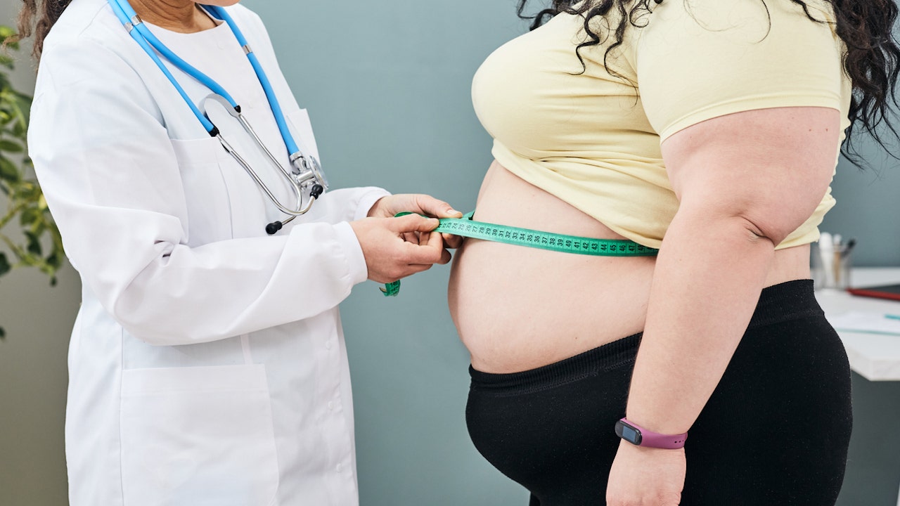 Las tasas generales de obesidad disminuyen en los Estados Unidos, mientras que la obesidad grave continúa aumentando: Centros para el Control y la Prevención de Enfermedades