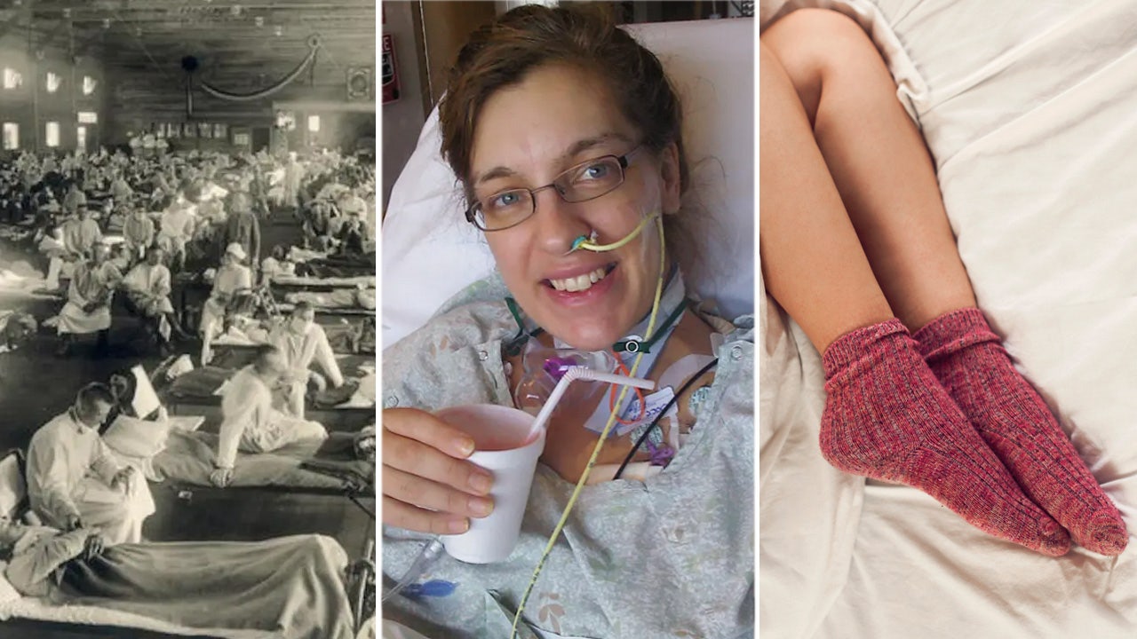 Woman loses leg to flu, skeletons reveal pandemic truths, and expert shares sleeping tip - Fox News