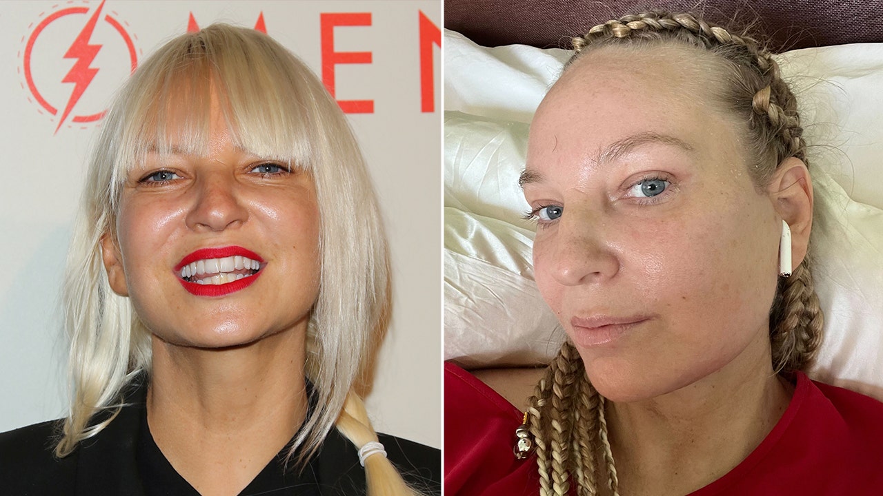 'Chandelier’ singer Sia’s plastic surgeon reveals why she was honest about facelift at 47, 'No shame in it'