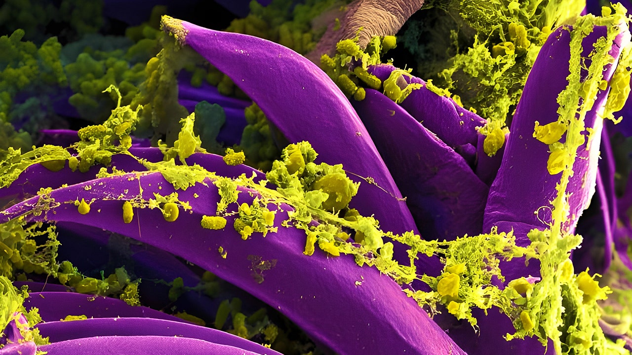 Първият случай на бубонна чума при хора в Орегон, потвърден от здравните власти от 2015 г