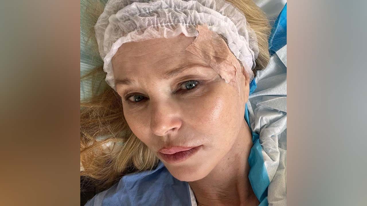 Former Supermodel Christie Brinkley Reveals Skin Cancer Diagnosis