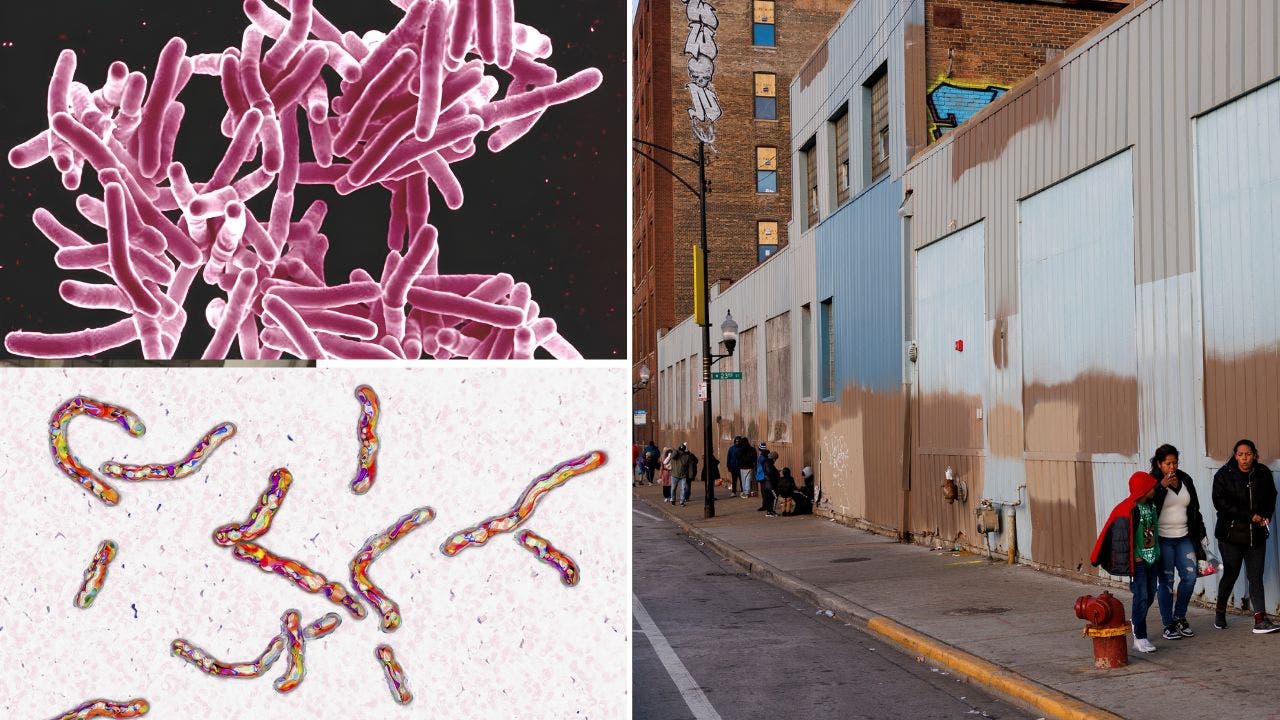 Read more about the article Tuberculosis breaks out at Chicago migrant shelters following measles cases