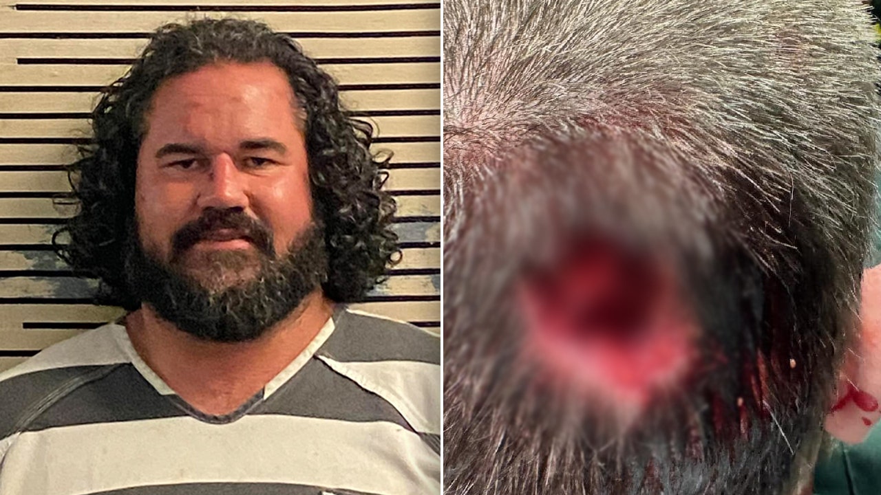 Florida man bit chunk out of deputy’s head at music festival: sheriff’s office