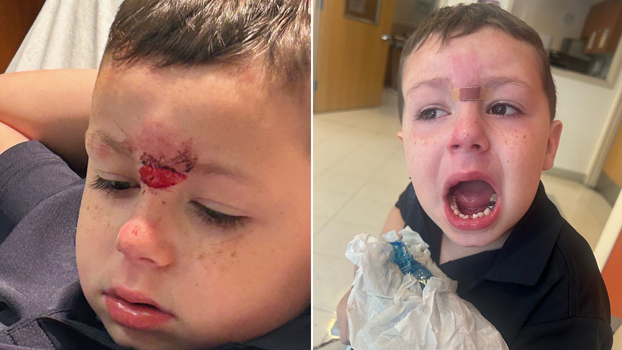 Read more about the article Pennsylvania dad demands answers after son, 5, has teeth knocked out in bloody assault at school, lawyer says