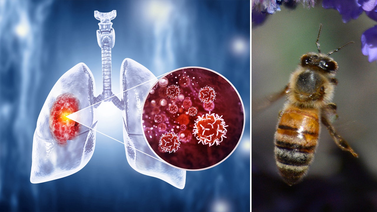 Read more about the article Honeybees can detect lung cancer, researchers say