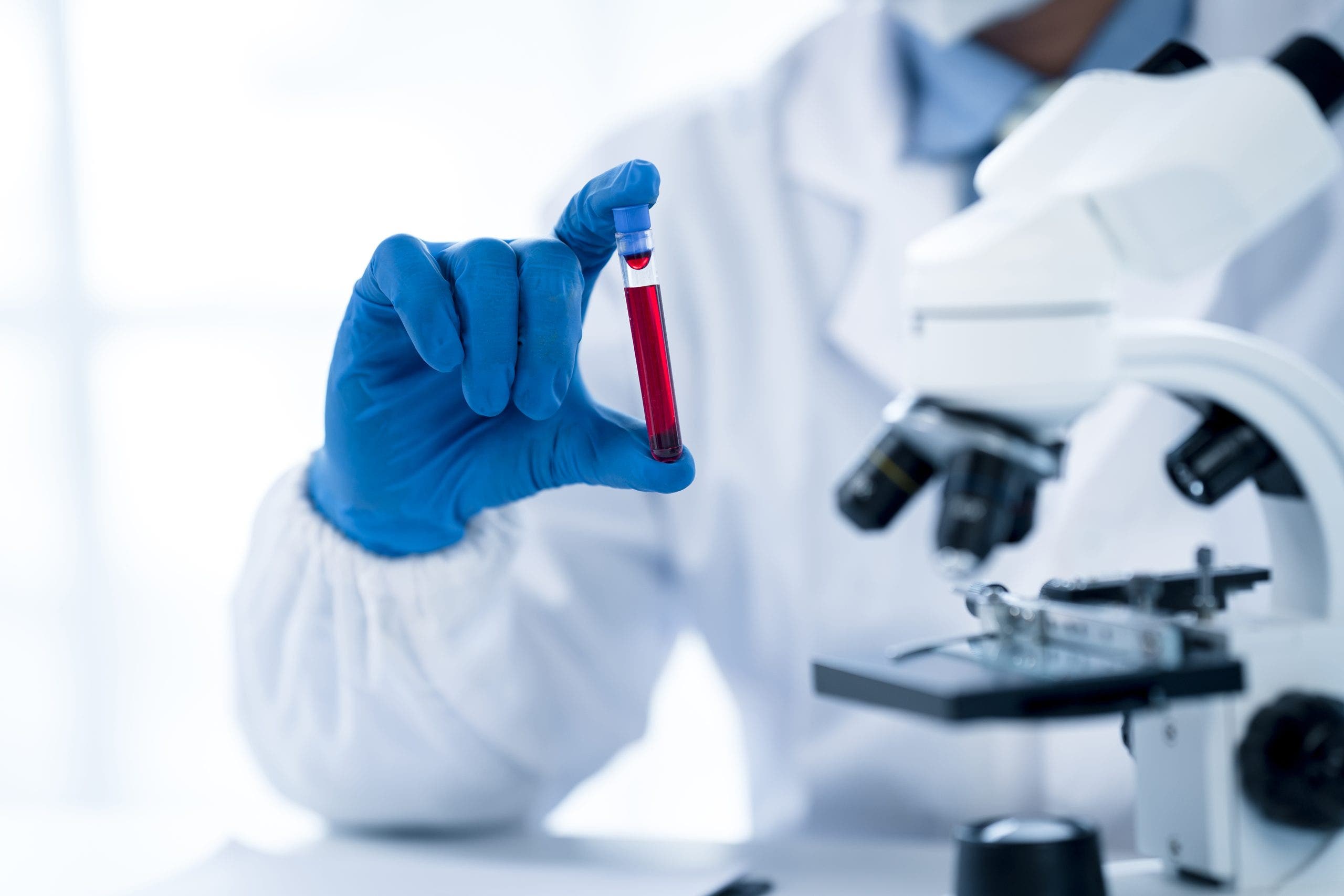 Colon cancer blood screening test approved by FDA: ‘Early detection is critical’