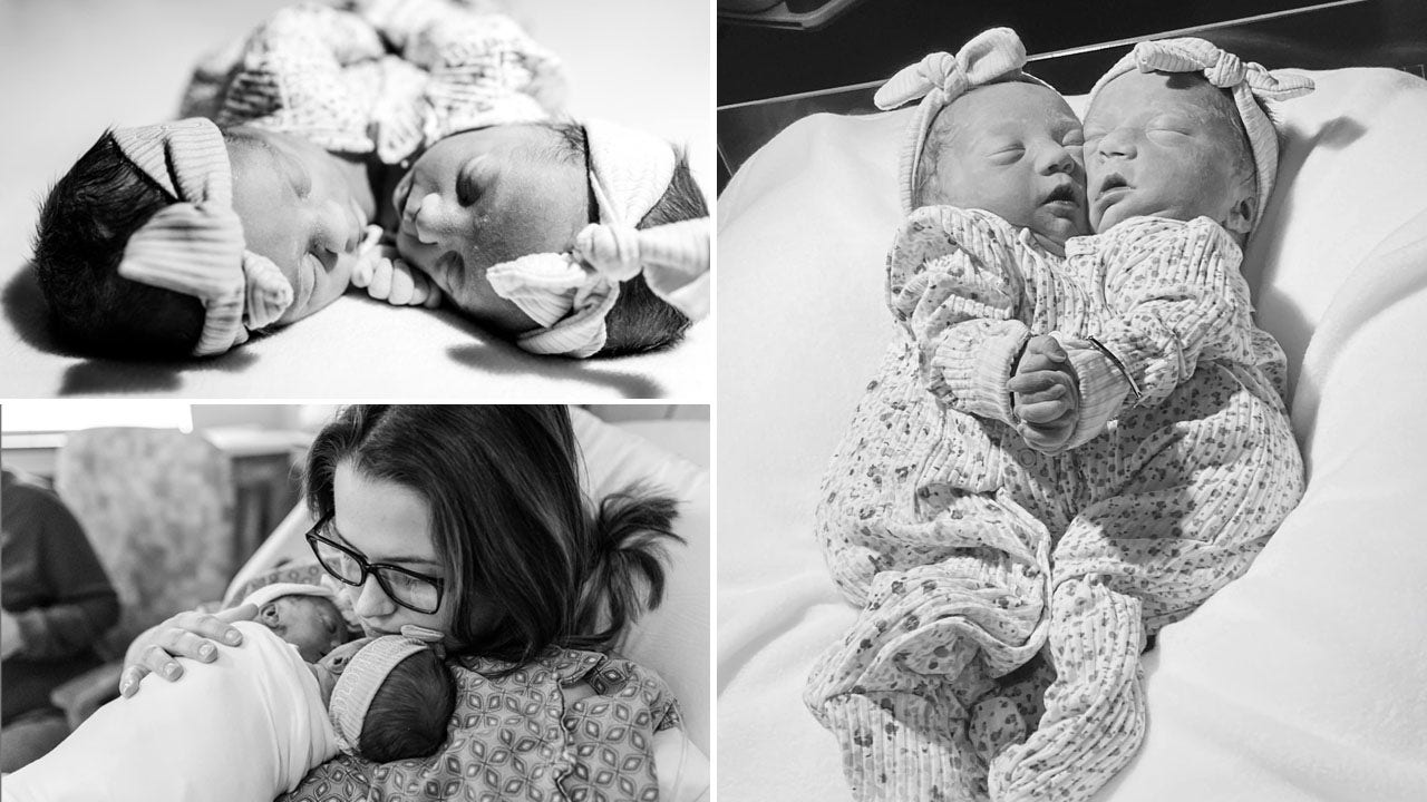 Atlanta couple’s conjoined twin daughters, sharing one heart, lived for an hour