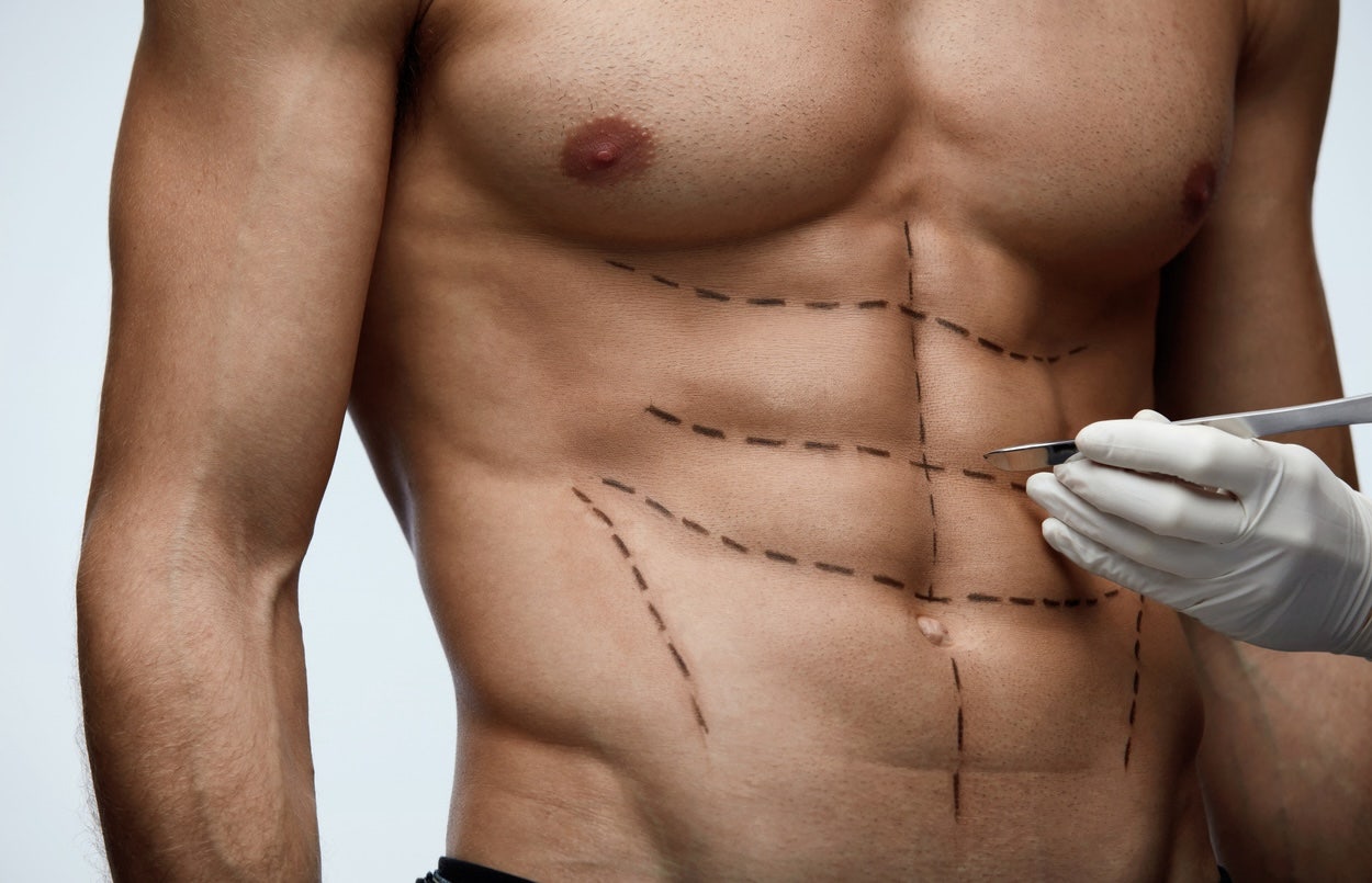 ‘Six-pack surgery’ gaining popularity among men, say plastic surgeons