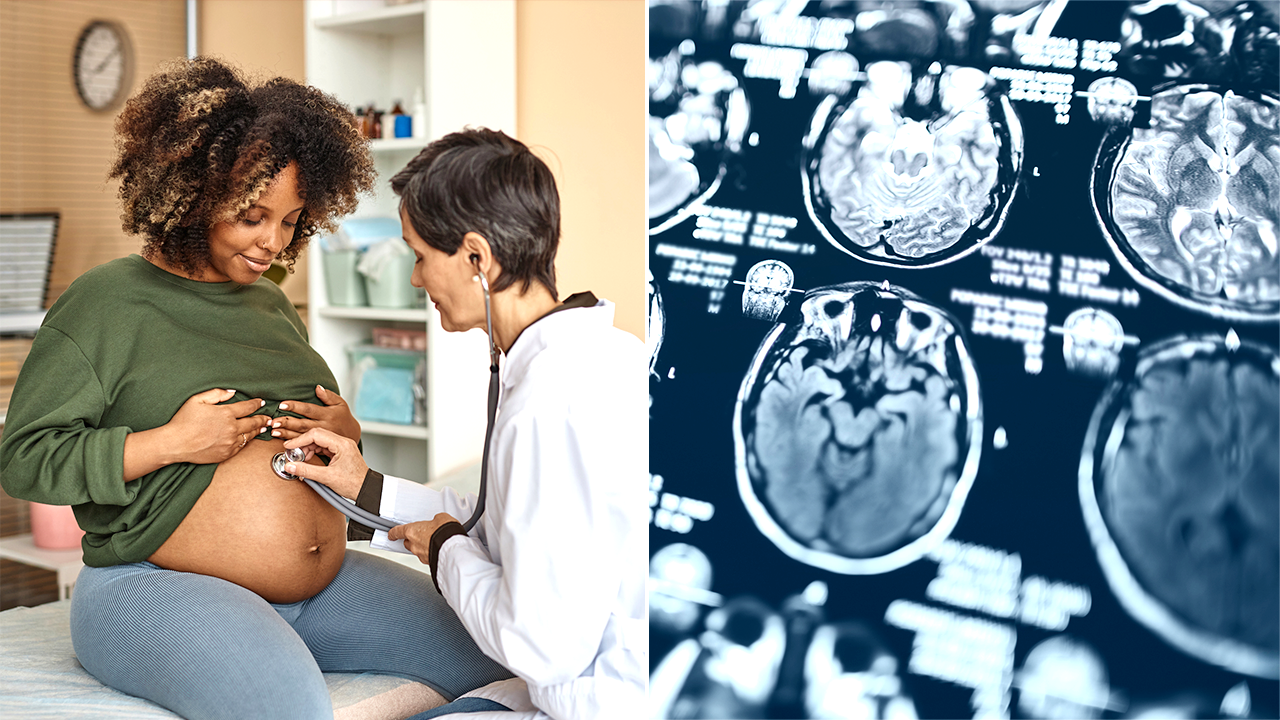 How pregnancy changes a woman’s brain, according to a new study