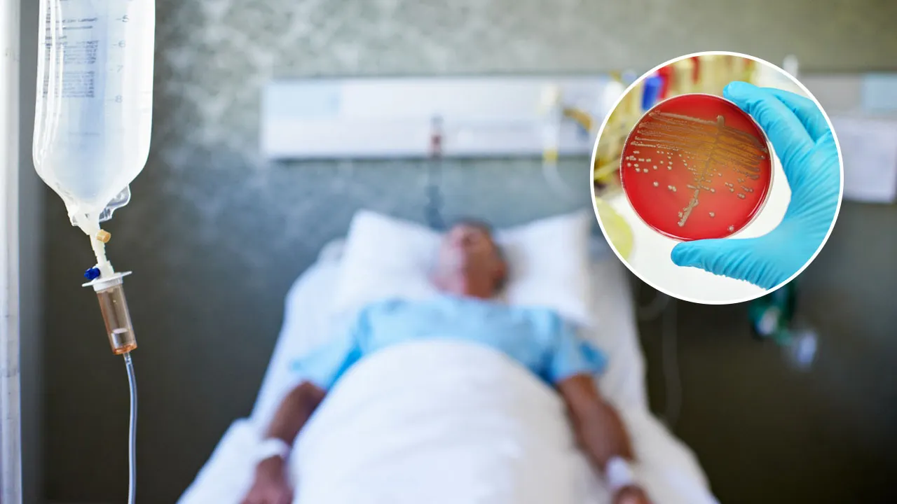 Sepsis a top killer in US behind heart disease, cancer: What to know, how to avoid the condition