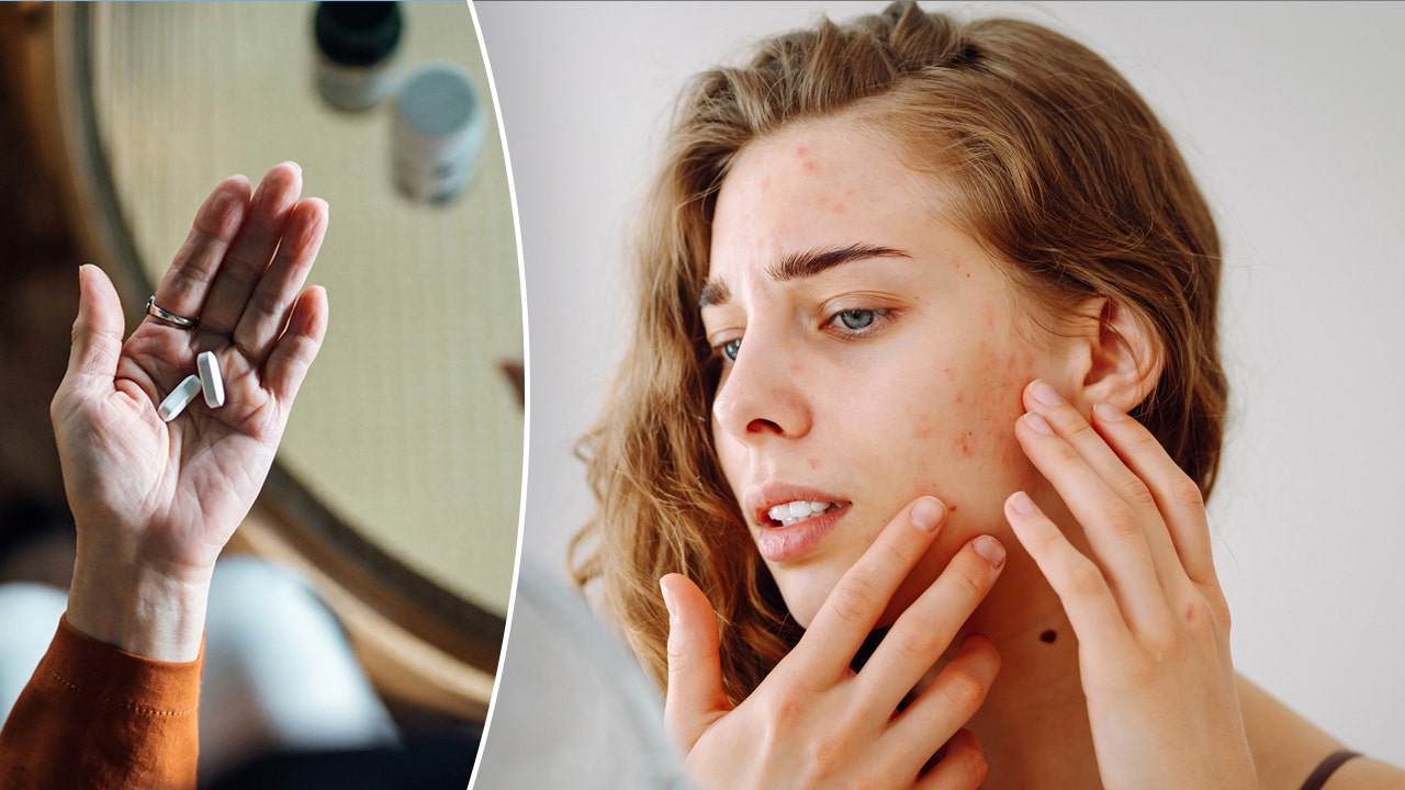 Minimize acne scars and incorporate these vitamins into your daily self-care routine - Fox News