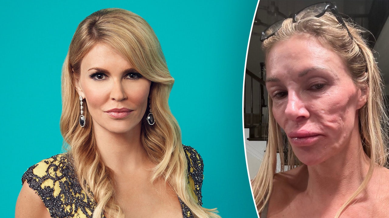 Brandi Glanville shares stripped down photo as she claims her ‘looks are ruined’ by mystery illness